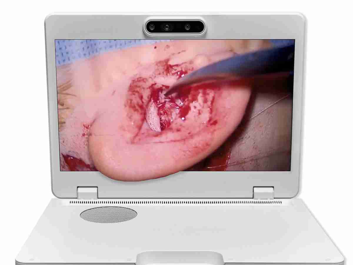 达擎之＂Heads-up 3D显微手术显示系统＂，，，，整合4K裸眼3D显示及眼球追踪系统，，具备快速追踪人眼移动位置功能，，，减轻医师长时间维持固定姿势的负担，，，，让医师能有更宽广清晰的3D立体视野及更舒适的姿势来执行手术。。